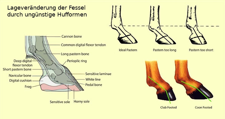 Lageveränderung der Fessel